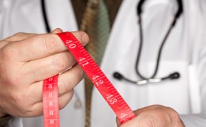 BMI body mass index for mini gastric bypass surgery