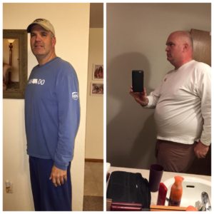 Mark Joyner Before & After Mini-Gastric Bypass