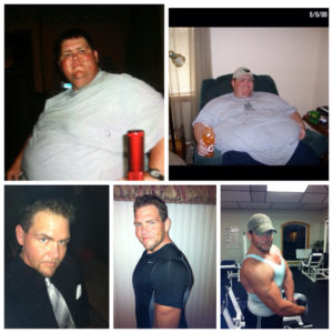 Ryan Atchison Before & After Mini-Gastric Bypass