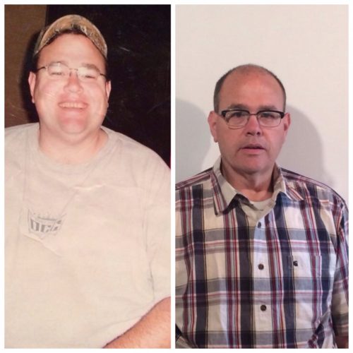 Steve Pelak Before & After Mini-Gastric Bypass